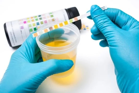 Urinalysis