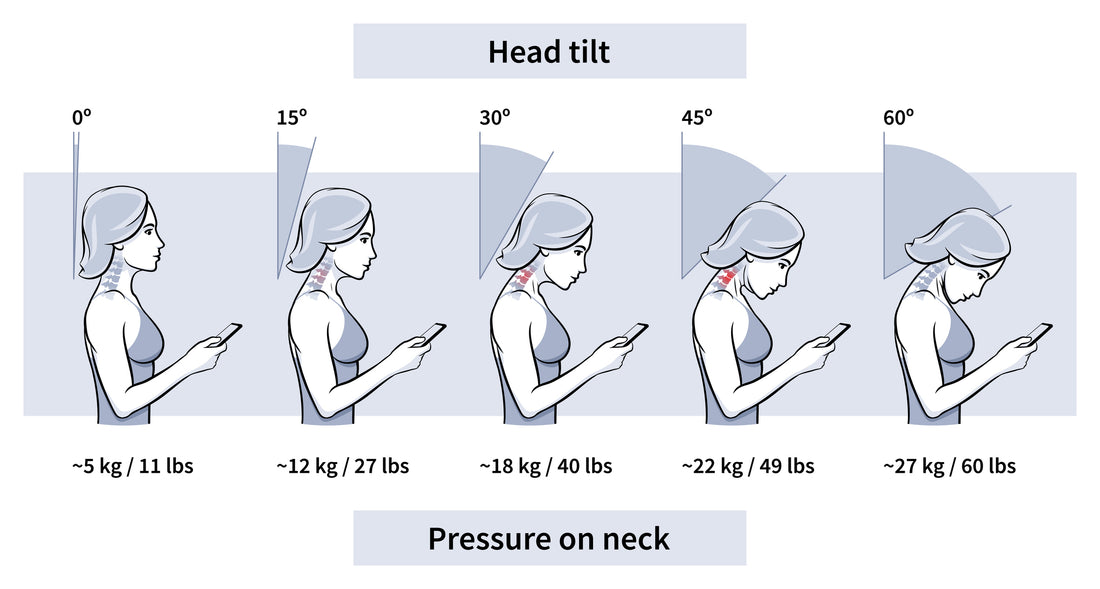 Text Neck